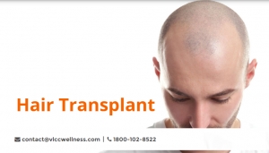 Best Hair Transplant Clinics -VLCC India